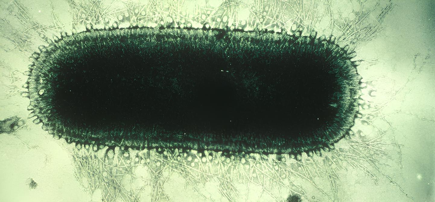 Electron microscope image of rabies virus
