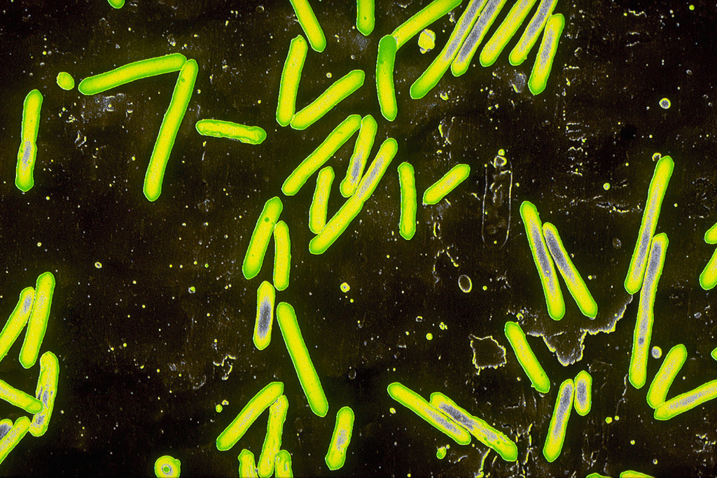 Microscope image of tetanus bacilli (clostrium tetani) that cause tetanus

