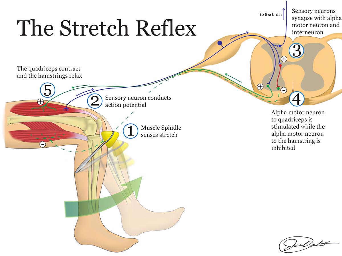 Stretch Reflex or myotatic reflex