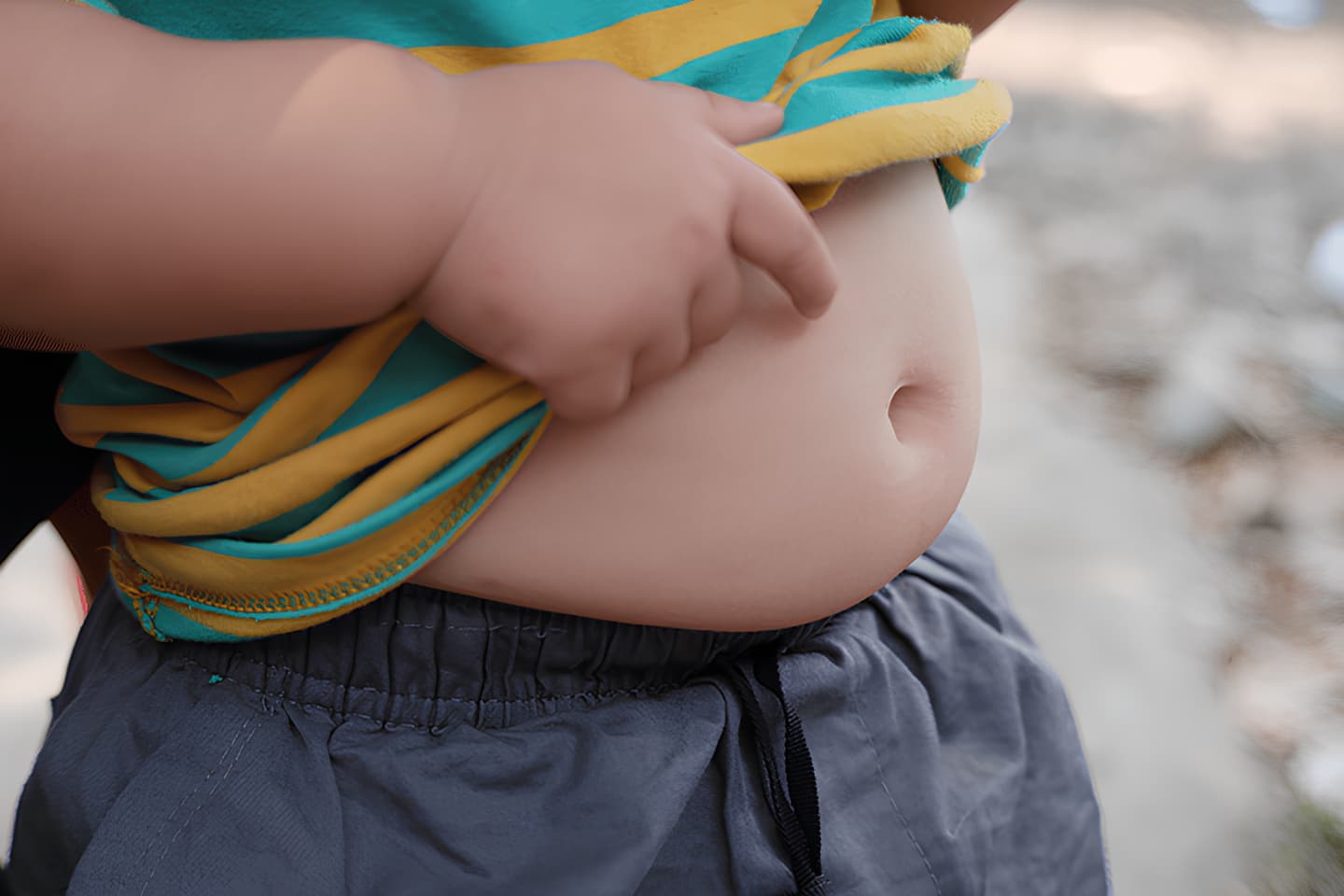 Obesity in Adolescence Is a Major Risk Factor for 17 Types of Cancer